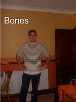 bones